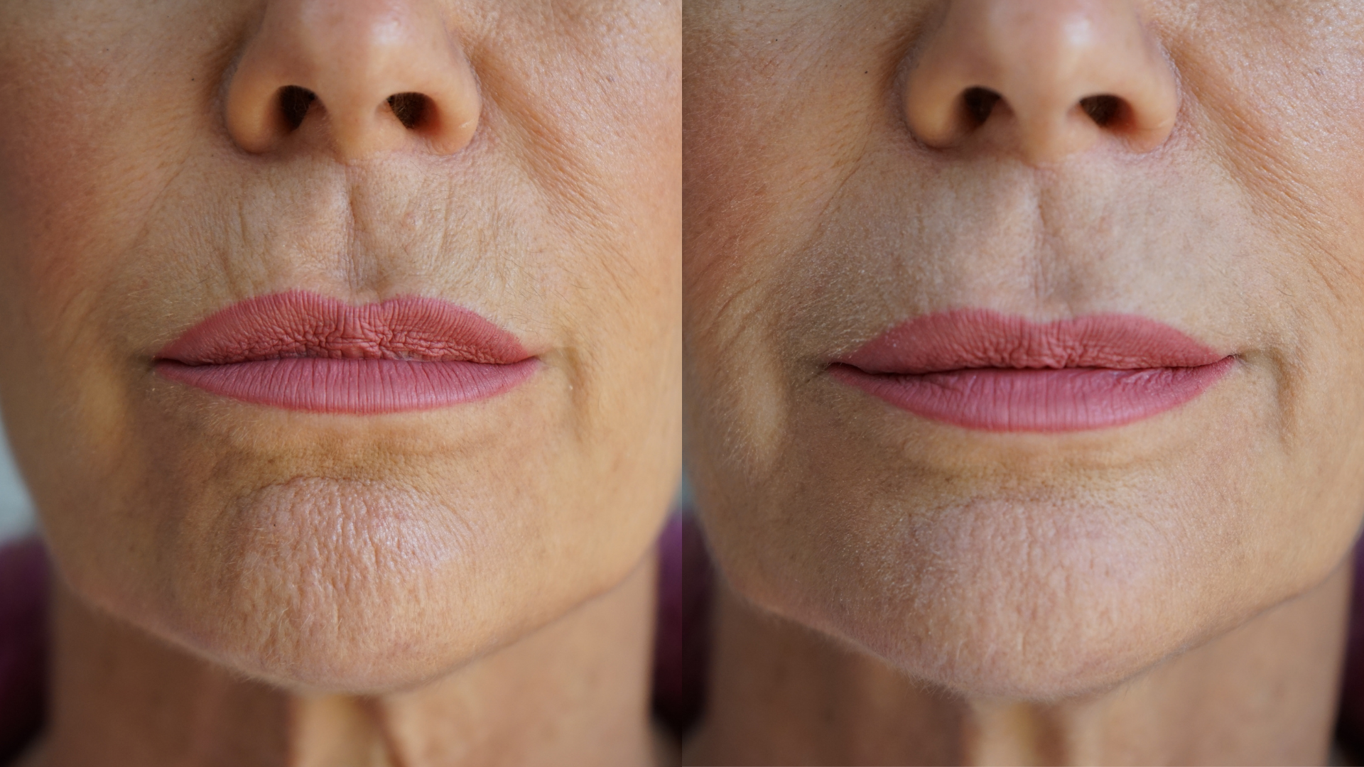 Ageless Lip & Line Filler by PRAI Beauty