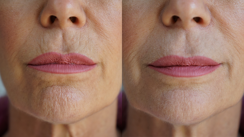 Ageless Lip & Line Filler by PRAI Beauty