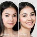 Pimple & Acne Patches by Maree