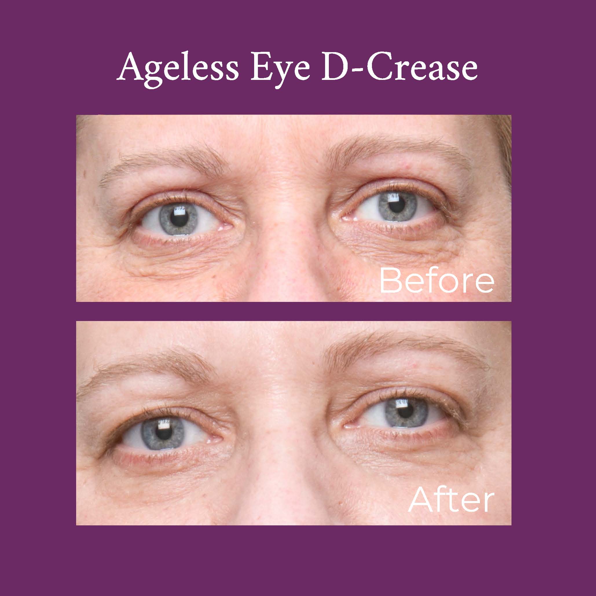 Ageless Eye D-Crease by PRAI Beauty