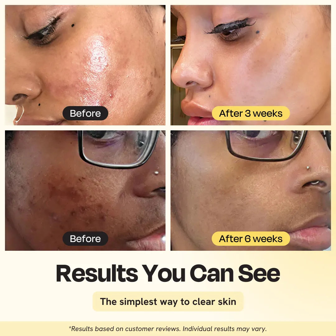 Jumbo Vitamin C Clay Mask by Gleamin