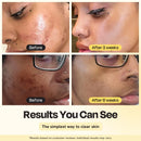 Jumbo Vitamin C Clay Mask by Gleamin