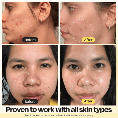 Vitamin C Clay Mask by Gleamin