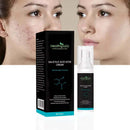 HealthyAsia Black Label Salicylic Acid Acne Cream - Max Strength Formula by HealthyAsia