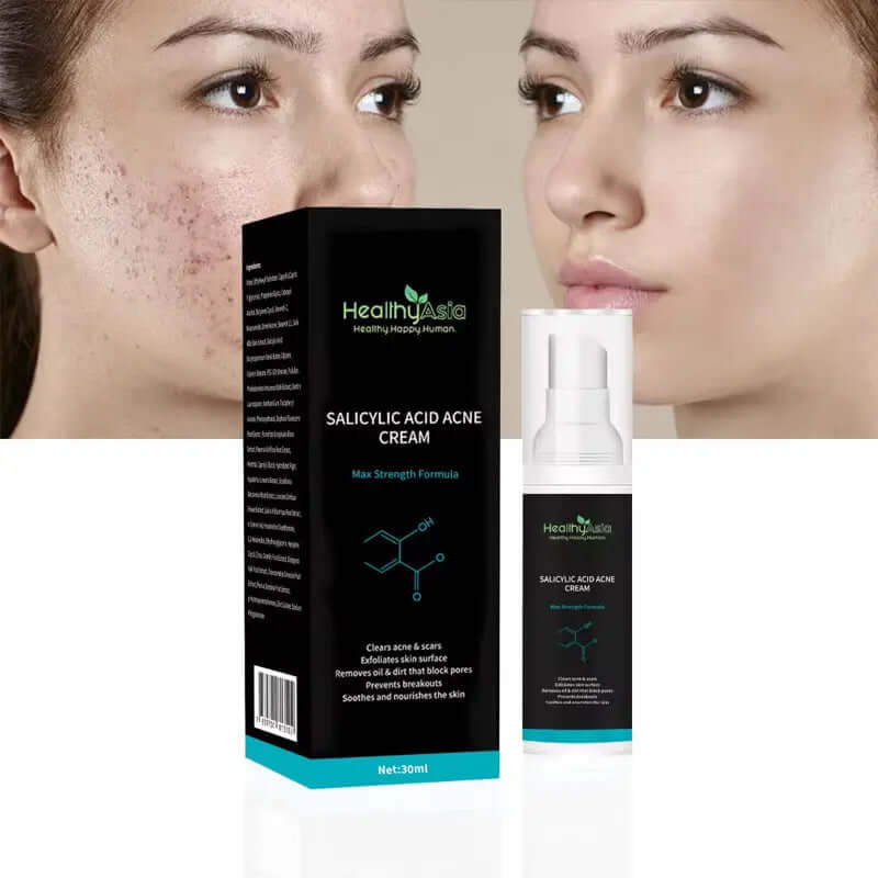HealthyAsia Black Label Salicylic Acid Acne Cream - Max Strength Formula by HealthyAsia