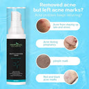HealthyAsia Black Label Salicylic Acid Acne Cream - Max Strength Formula by HealthyAsia