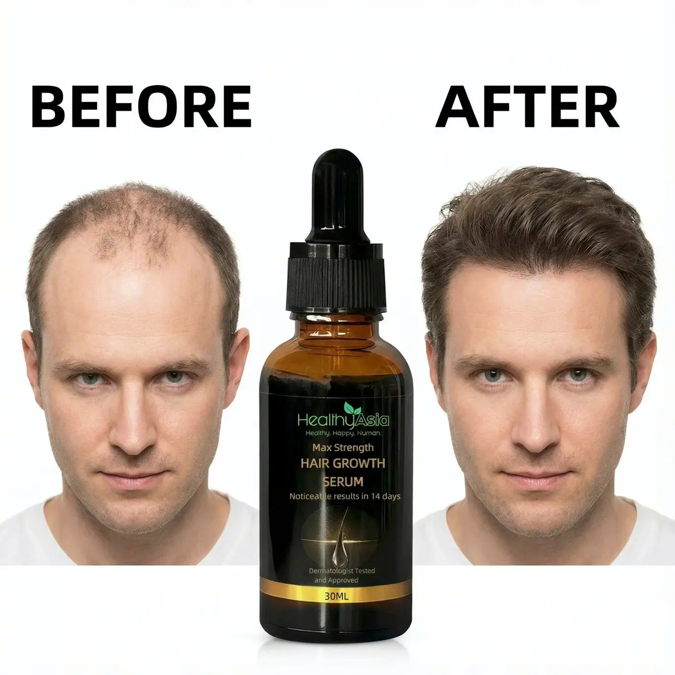 HealthyAsia Black Label Max-Strength Hair Growth Serum by HealthyAsia