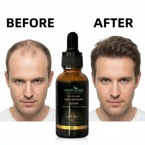 HealthyAsia Black Label Max-Strength Hair Growth Serum by HealthyAsia