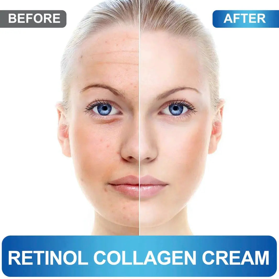 HealthyAsia Black Label Retinol Collagen Anti-Aging Cream by HealthyAsia