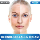 HealthyAsia Black Label Retinol Collagen Anti-Aging Cream by HealthyAsia