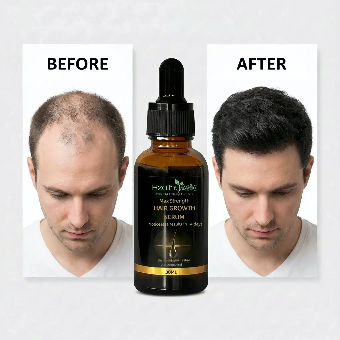 Max Strength Hair Growth Serum HealthyAsia