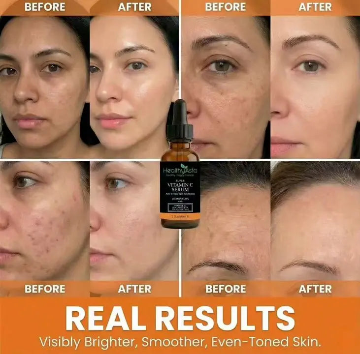 HealthyAsia Black Label Super C Vitamin C Serum – Anti-Aging & Brightening Face Serum – Firming & Anti-Wrinkle Treatment by HealthyAsia
