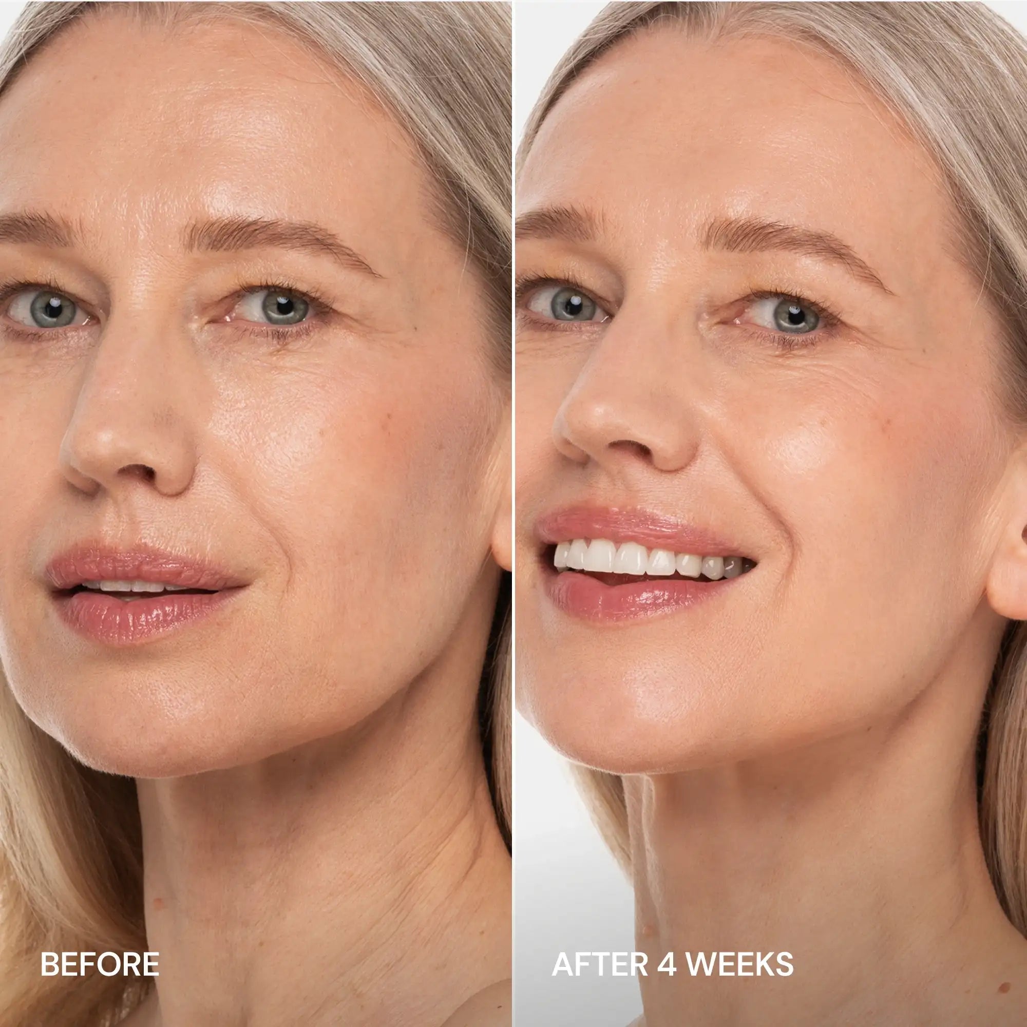 Pro-Retinol Neck Lifting Cream Massager by Maree